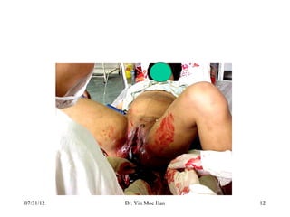 07/31/12   Dr. Yin Moe Han   12
 