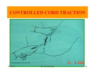 CONTROLLED CORD TRACTION




07/31/12   Dr. Yin Moe Han   14
 