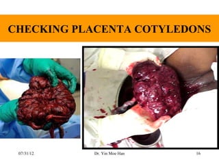 CHECKING PLACENTA COTYLEDONS




 07/31/12   Dr. Yin Moe Han   16
 