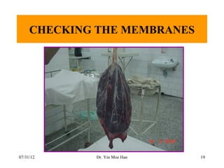 CHECKING THE MEMBRANES




07/31/12     Dr. Yin Moe Han   19
 