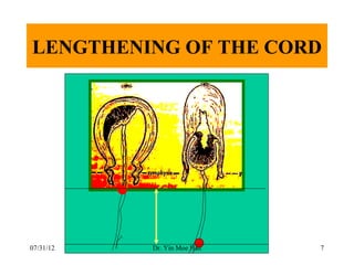 LENGTHENING OF THE CORD




07/31/12   Dr. Yin Moe Han   7
 