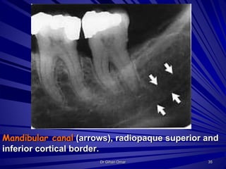 Mandibular canal (arrows), radiopaque superior and
inferior cortical border.
35Dr Gihan Omar
 