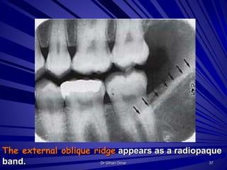 Oblique Ridge Radiography Normal radiographic landmarks | PPTX