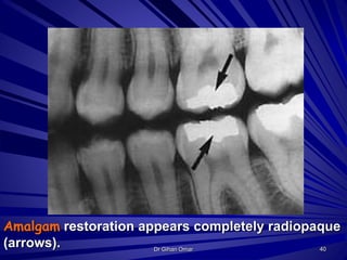 Normal radiographic landmarks | PPTX