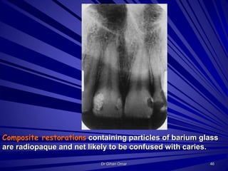Normal radiographic landmarks | PPTX