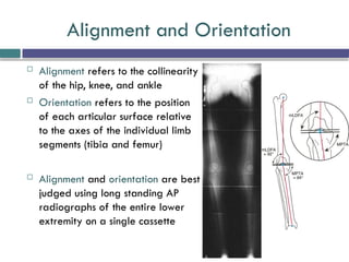 Comprehensive Overview of Normal Lower Limb Alignment and Joint ...