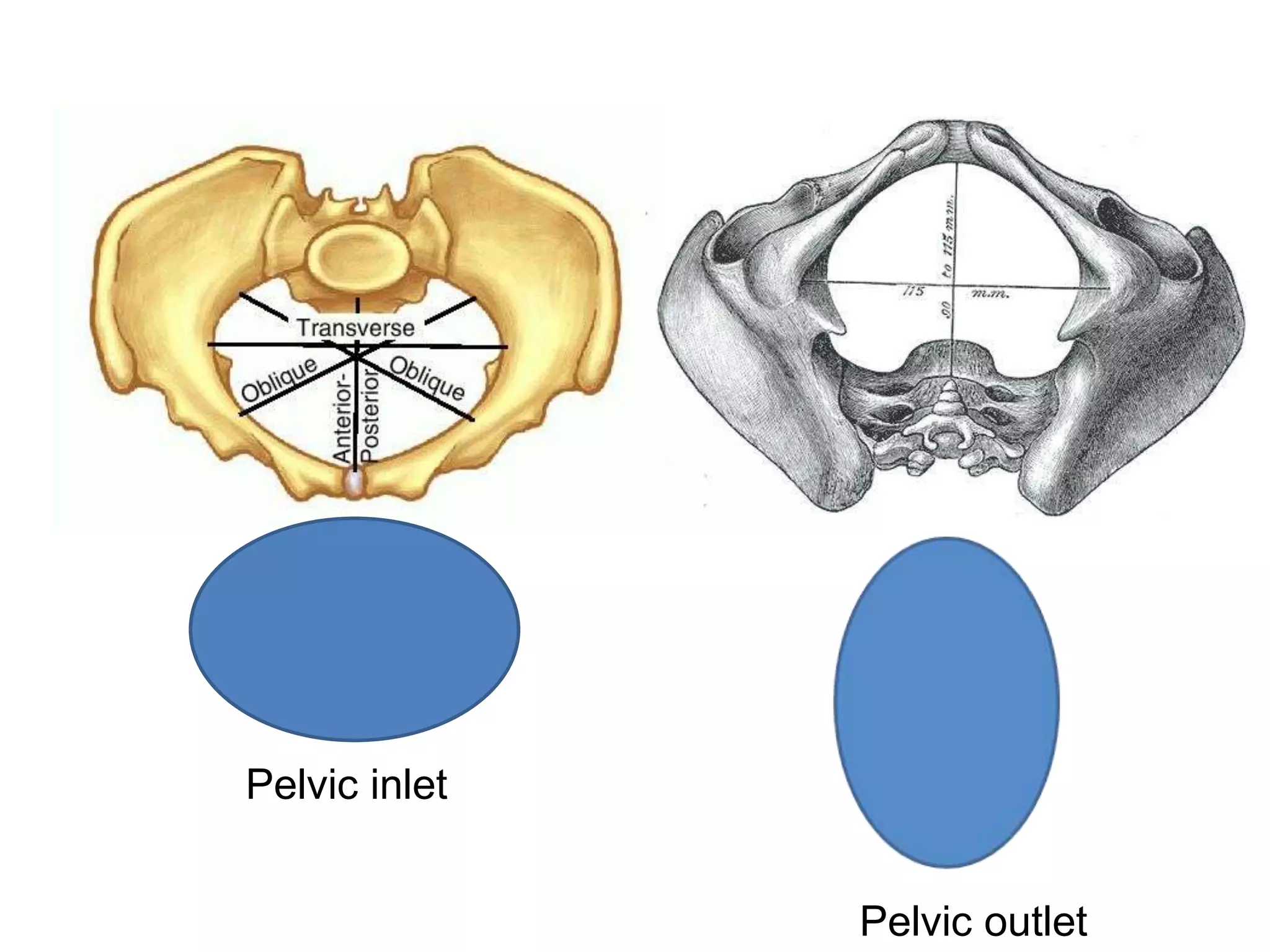 Pelvic inlet
Pelvic outlet