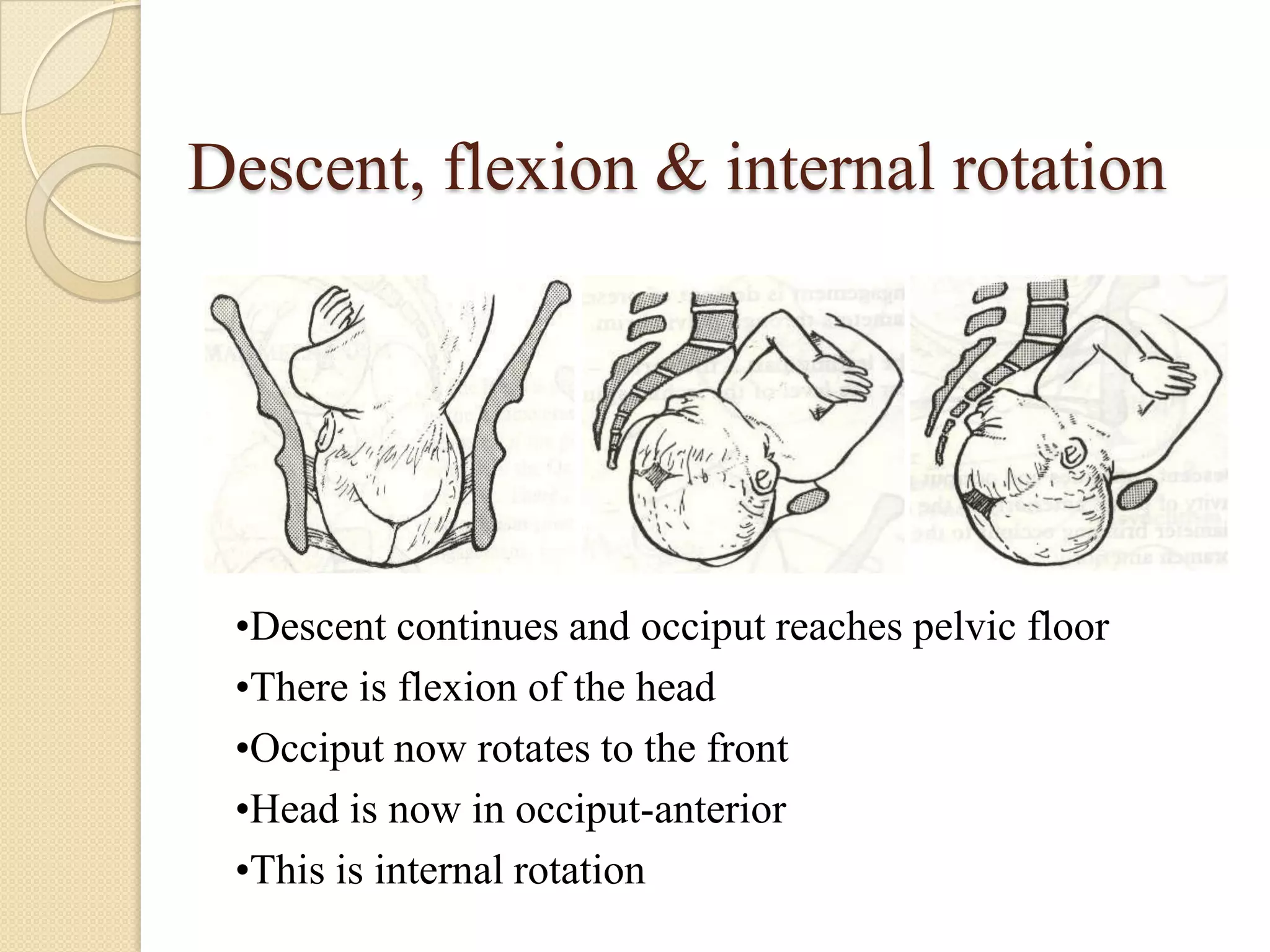 Descent, flexion & internal rotation
•Descent continues and occiput reaches pelvic floor
•There is flexion of the head
•Occiput now rotates to the front
•Head is now in occiput-anterior
•This is internal rotation