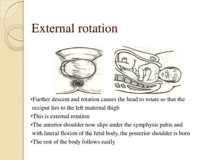 Normal mechanism of labour
