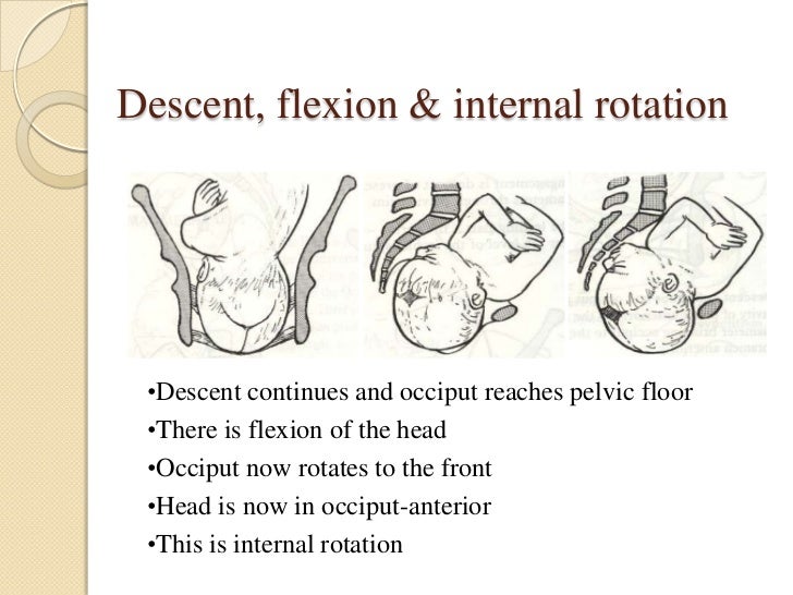 Normal mechanism of labour