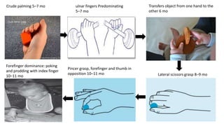 Prodding Object Normal motor development - infants | PPTX