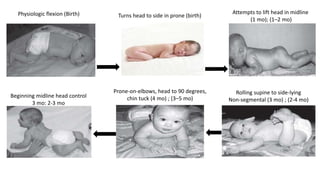 Normal motor development - infants | PPTX