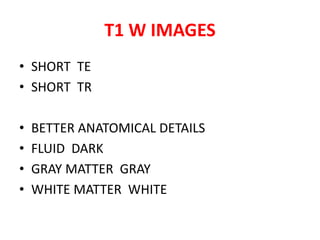• SHORT TE
• SHORT TR
• BETTER ANATOMICAL DETAILS
• FLUID DARK
• GRAY MATTER GRAY
• WHITE MATTER WHITE
T1 W IMAGES
 