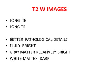 • LONG TE
• LONG TR
• BETTER PATHOLOGICAL DETAILS
• FLUID BRIGHT
• GRAY MATTER RELATIVELY BRIGHT
• WHITE MATTER DARK
T2 W IMAGES
 