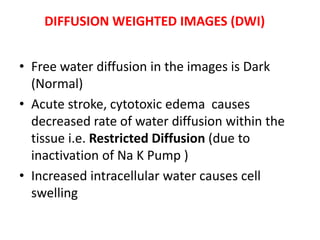 • Free water diffusion in the images is Dark
(Normal)
• Acute stroke, cytotoxic edema causes
decreased rate of water diffusion within the
tissue i.e. Restricted Diffusion (due to
inactivation of Na K Pump )
• Increased intracellular water causes cell
swelling
DIFFUSION WEIGHTED IMAGES (DWI)
 