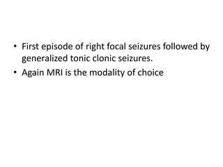 • First episode of right focal seizures followed by
generalized tonic clonic seizures.
• Again MRI is the modality of choice
 