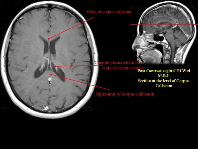 How Much Does A Brain Mri Cost In California
