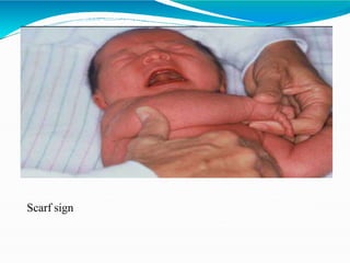 normal newborn.pptx