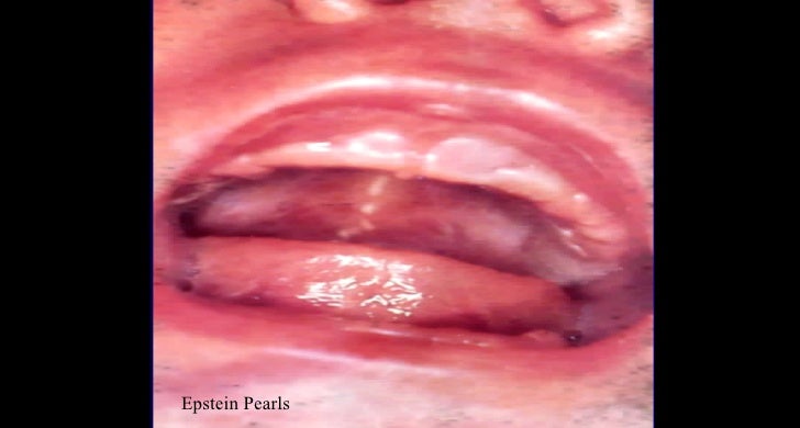 Normal newborn final