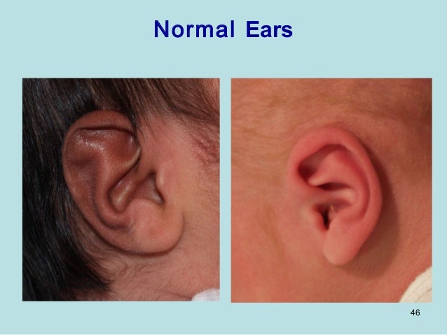 Normal Newborn normal-newborn
