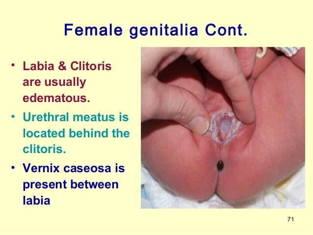 Gapping asshole with cum inside Swinging baby cause shaken baby syndrome