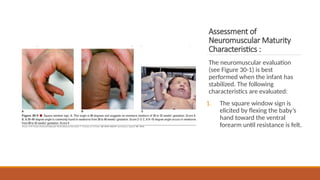 Normal Newborn and immediate care, nursing care | PPTX