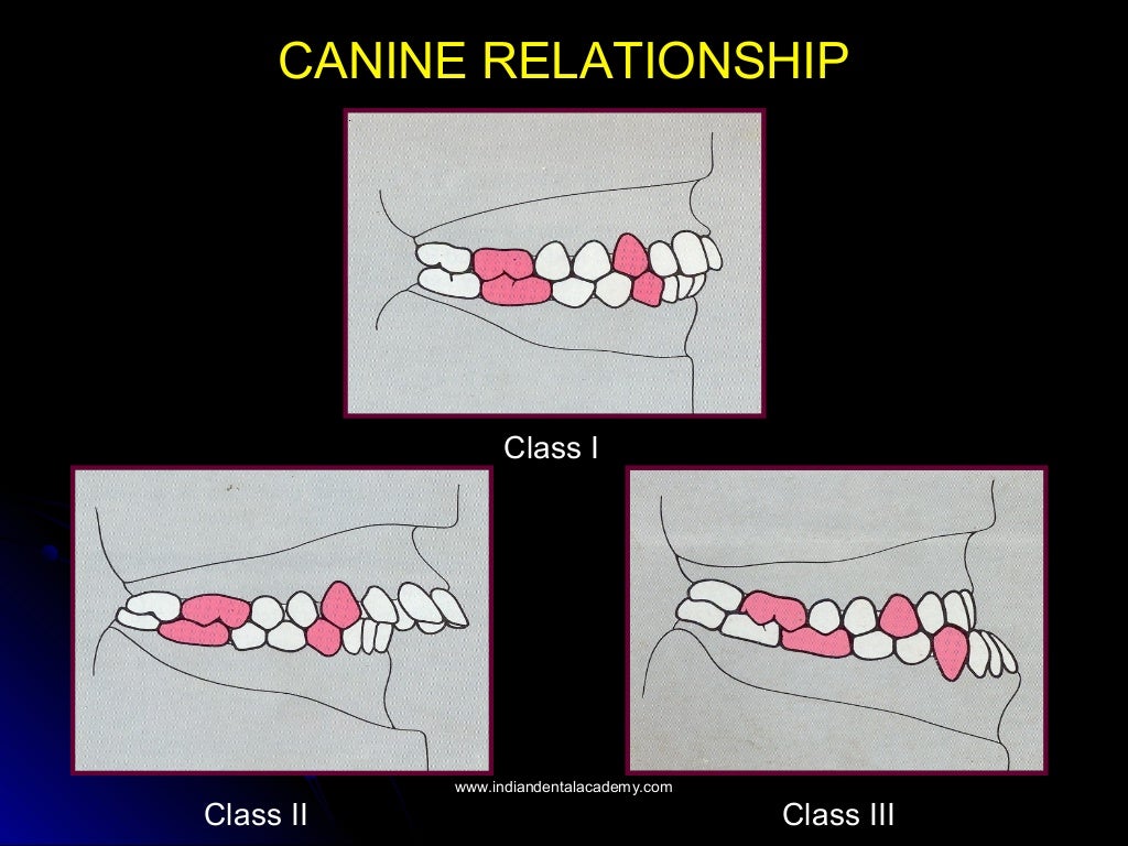 Normal occlusion