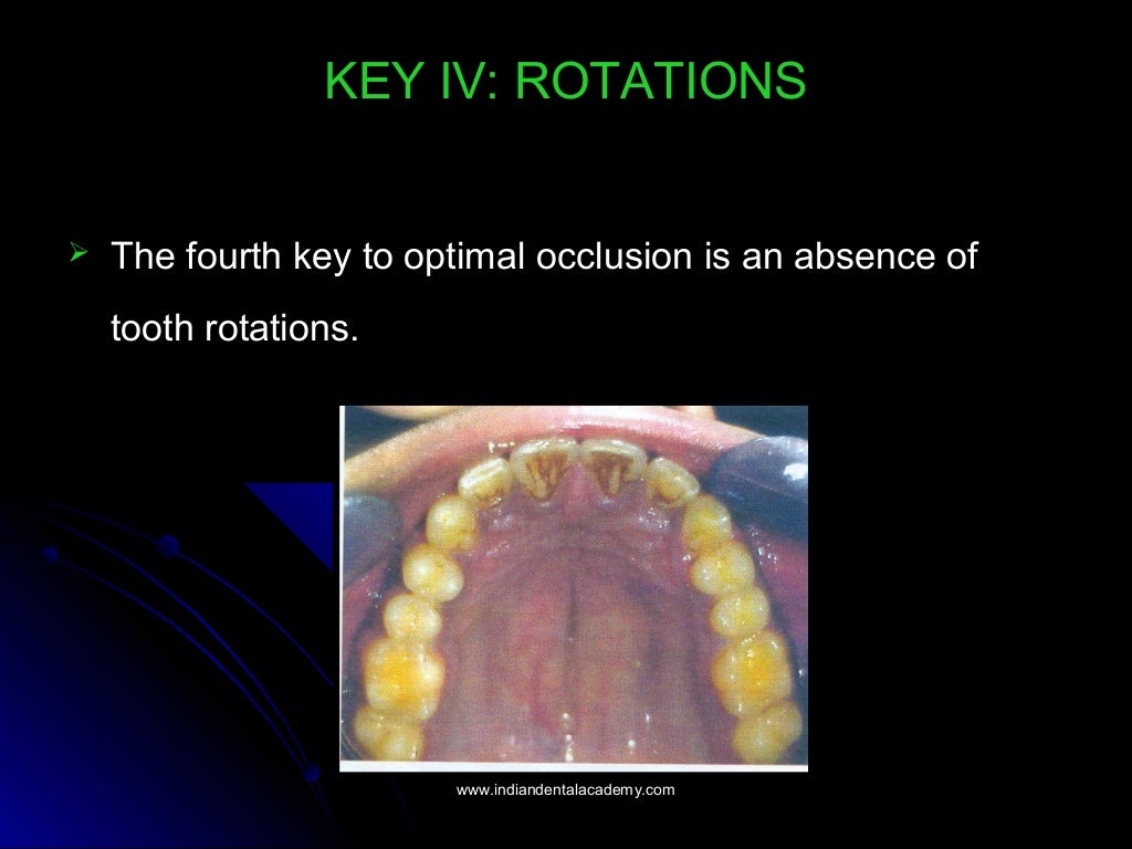 Normal occlusion