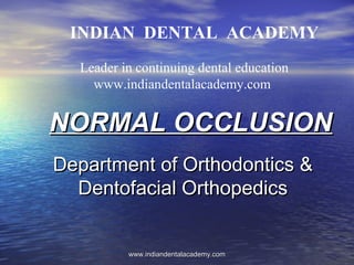 INDIAN DENTAL ACADEMY
Leader in continuing dental education
www.indiandentalacademy.com

NORMAL OCCLUSION
Department of Orthodontics &
Dentofacial Orthopedics

www.indiandentalacademy.com

 