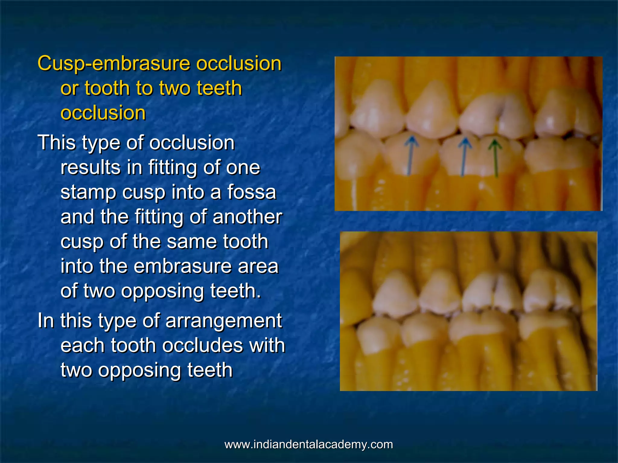 Normal occlusion (2)