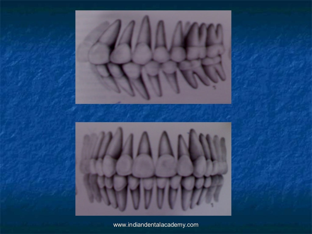 Normal occlusion (2)
