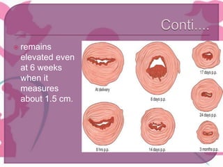  remains
elevated even
at 6 weeks
when it
measures
about 1.5 cm.
 