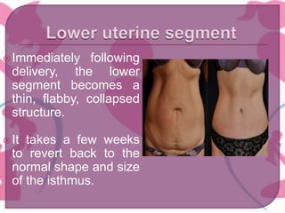 Immediately following
delivery, the lower
segment becomes a
thin, flabby, collapsed
structure.
It takes a few weeks
to revert back to the
normal shape and size
of the isthmus.
 