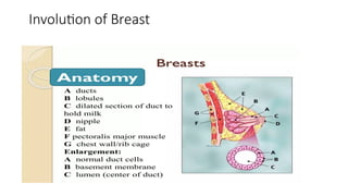 Involution of Breast
 