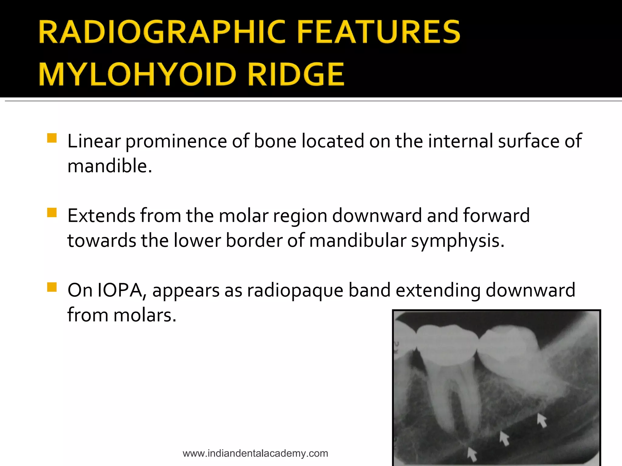 Normal radiographic anatomical landmarks / dental courses PPT