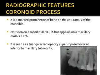 Romanulus Radiopaedia Normal Radiographic Anatomy | PPT