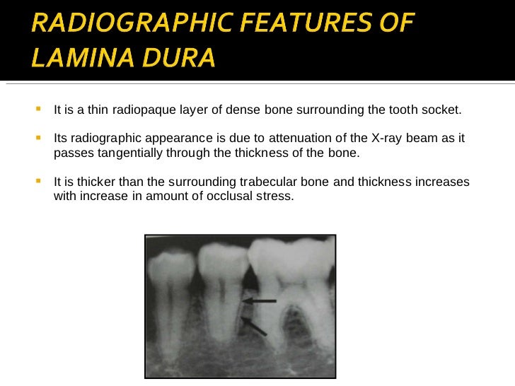 Normal Radiographic Anatomy
