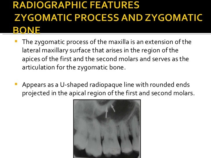 Normal Radiographic Anatomy