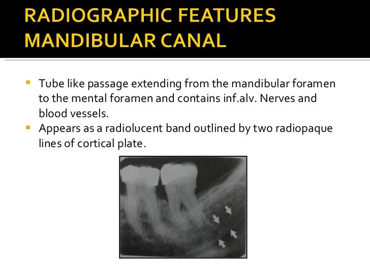 Normal Radiographic Anatomy