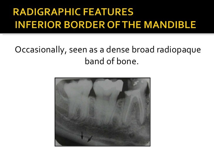 Normal Radiographic Anatomy