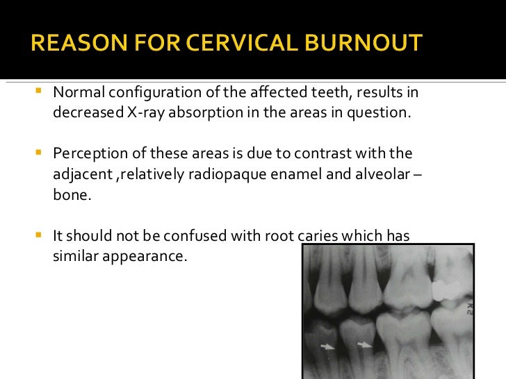 Normal Radiographic Anatomy