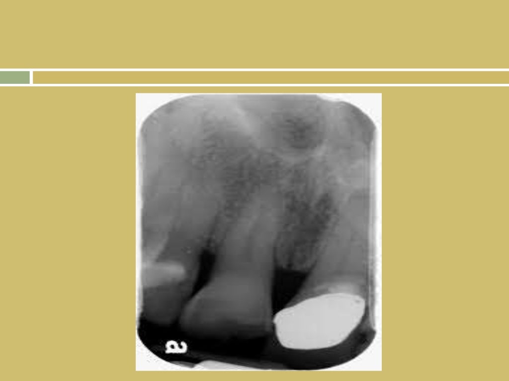 Normal oral radiographic anatomy