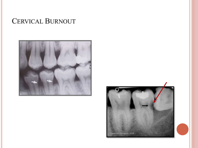 Normal radiographic anatomy | PPT