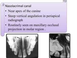 Normal radiographic anatomy .pptx
