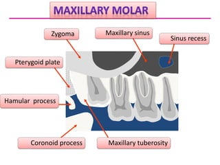 Normal radiographic anatomy .pptx