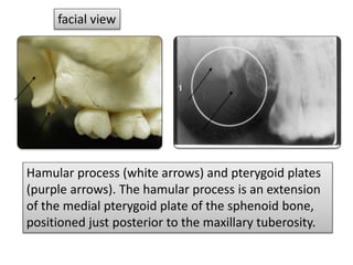Normal radiographic anatomy .pptx