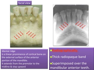 Normal radiographic anatomy .pptx