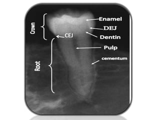 Normal radiographic anatomy .pptx