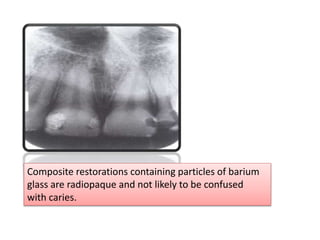 Normal radiographic anatomy .pptx