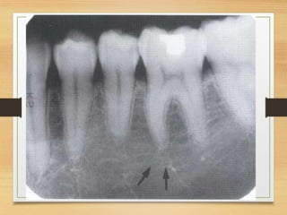 Normal radiographic anatomy in a human.pdf